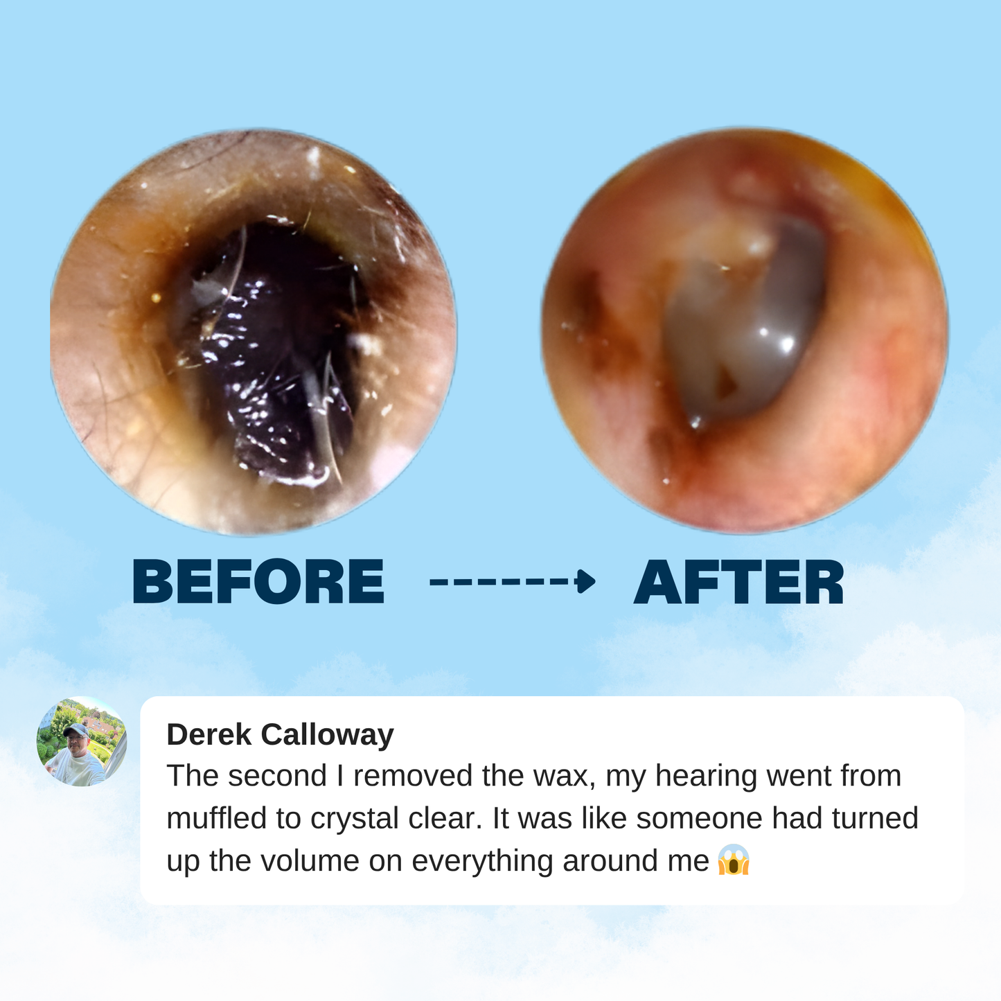 ClearEar™ Earwax Removal Kit