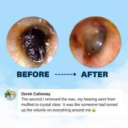 ClearEar™ Earwax Removal Kit